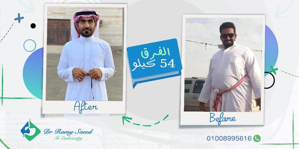 سعر الكبسولة المبرمجة