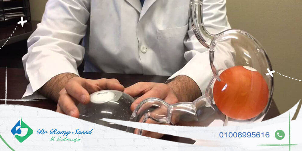 افضل انواع بالون المعدة