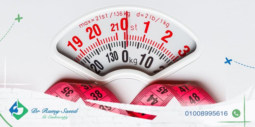 ما هي أفضل البدائل لعملية تكميم المعدة