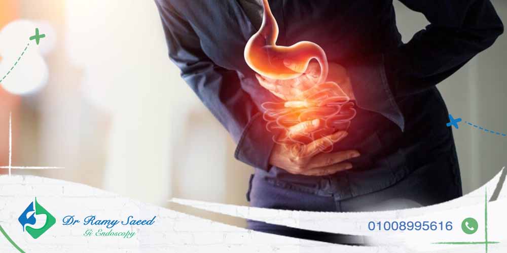 افضل دكتور لعلاج ارتجاع المرئ